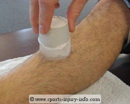 shin-splints-ice-massage